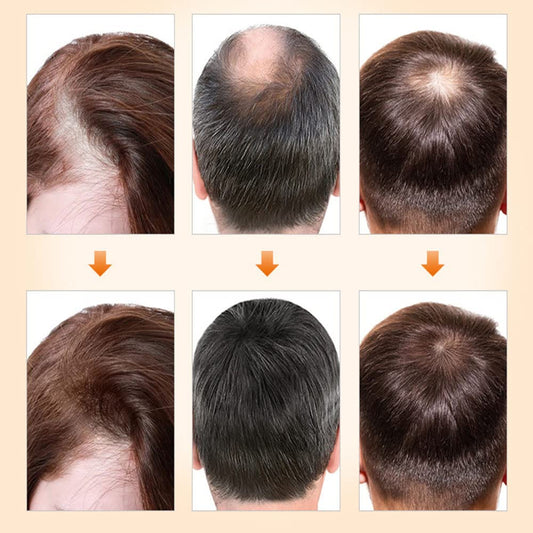 Natural Hair Density Essential Oil - Hair Growth Serum for Thicker Hair